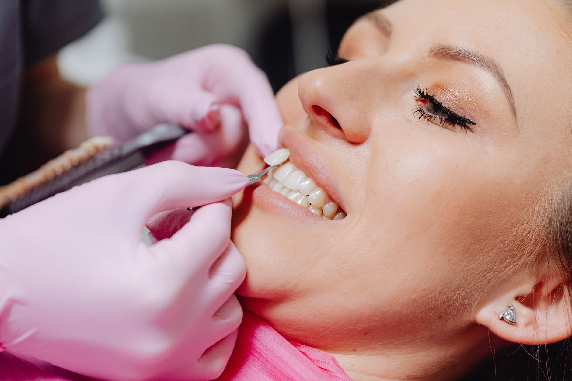 Sonrisa y blanqueamiento dental en cl&iacute;nica de Alicante