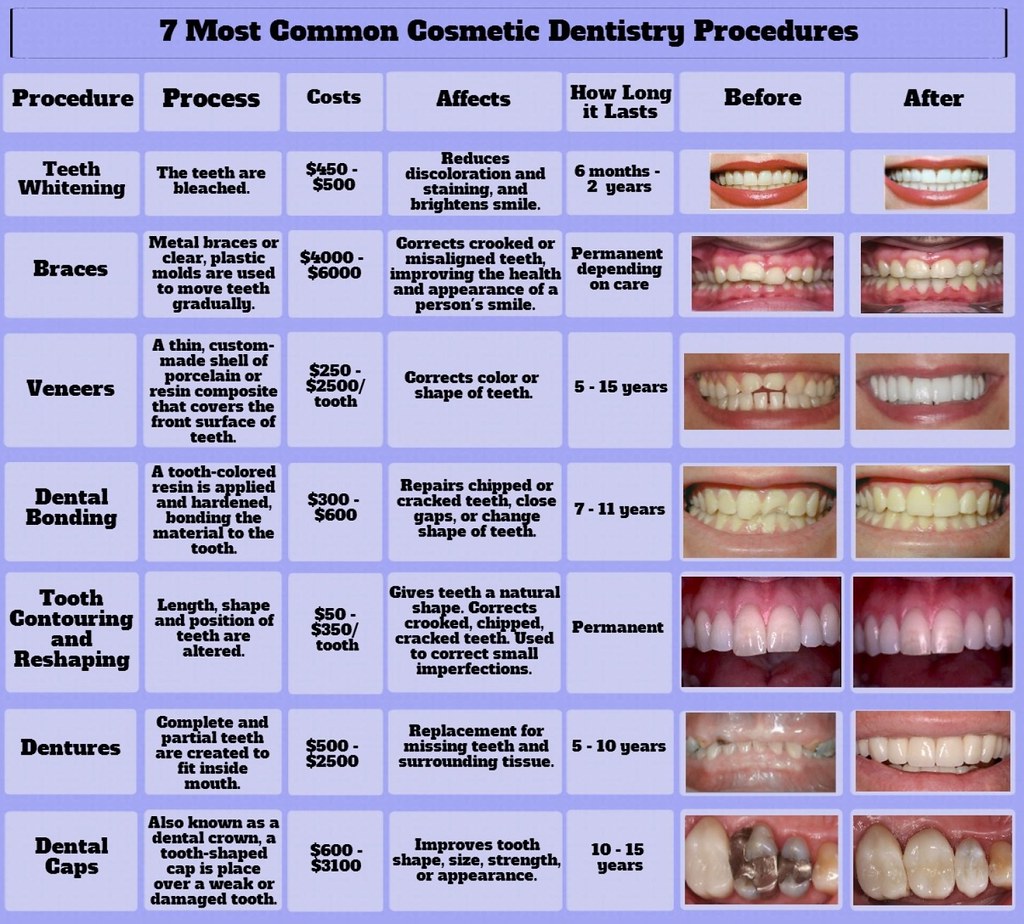 Tratamiento de implantes dentales en clínica de Bilbao