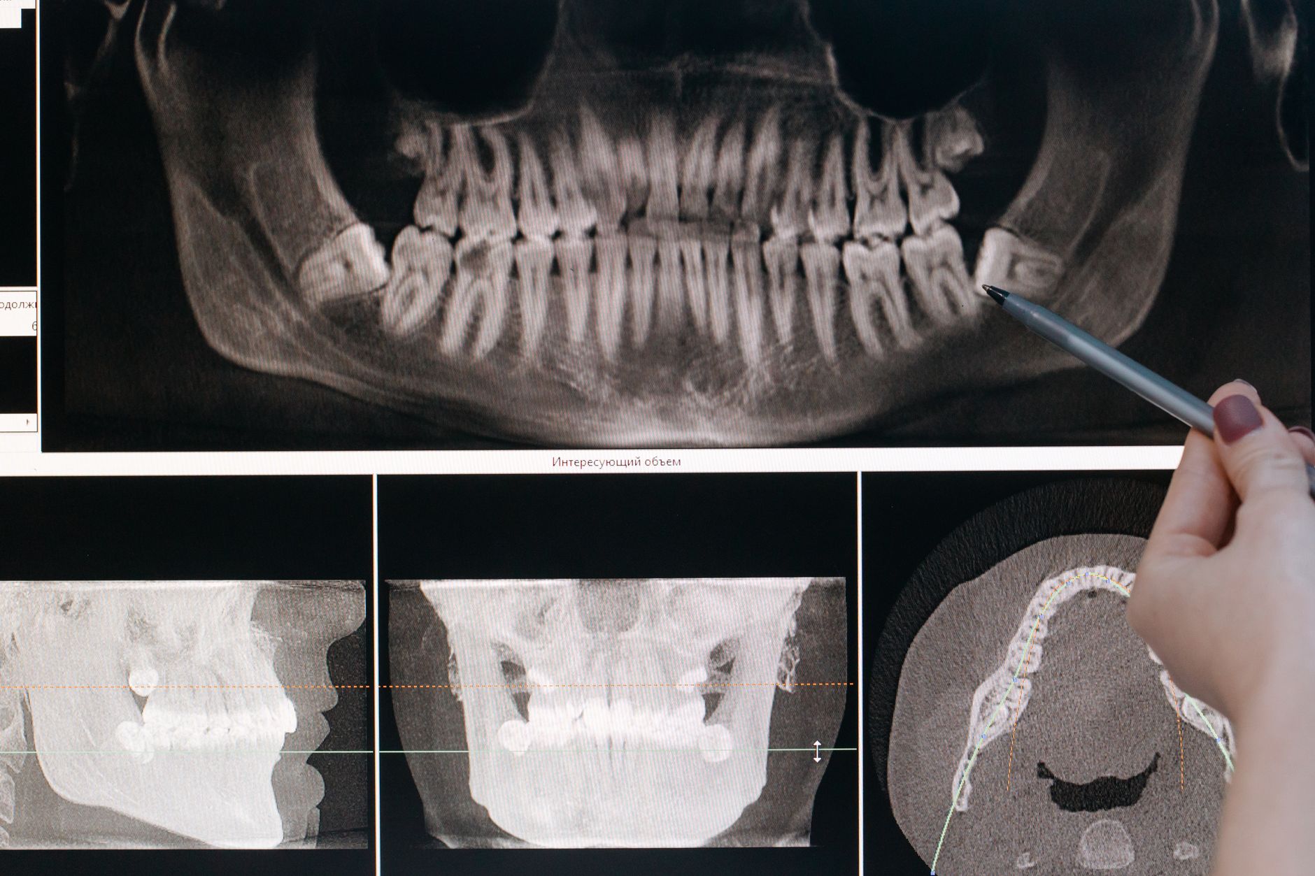 Hospital Dental en Oviedo — interior y servicios