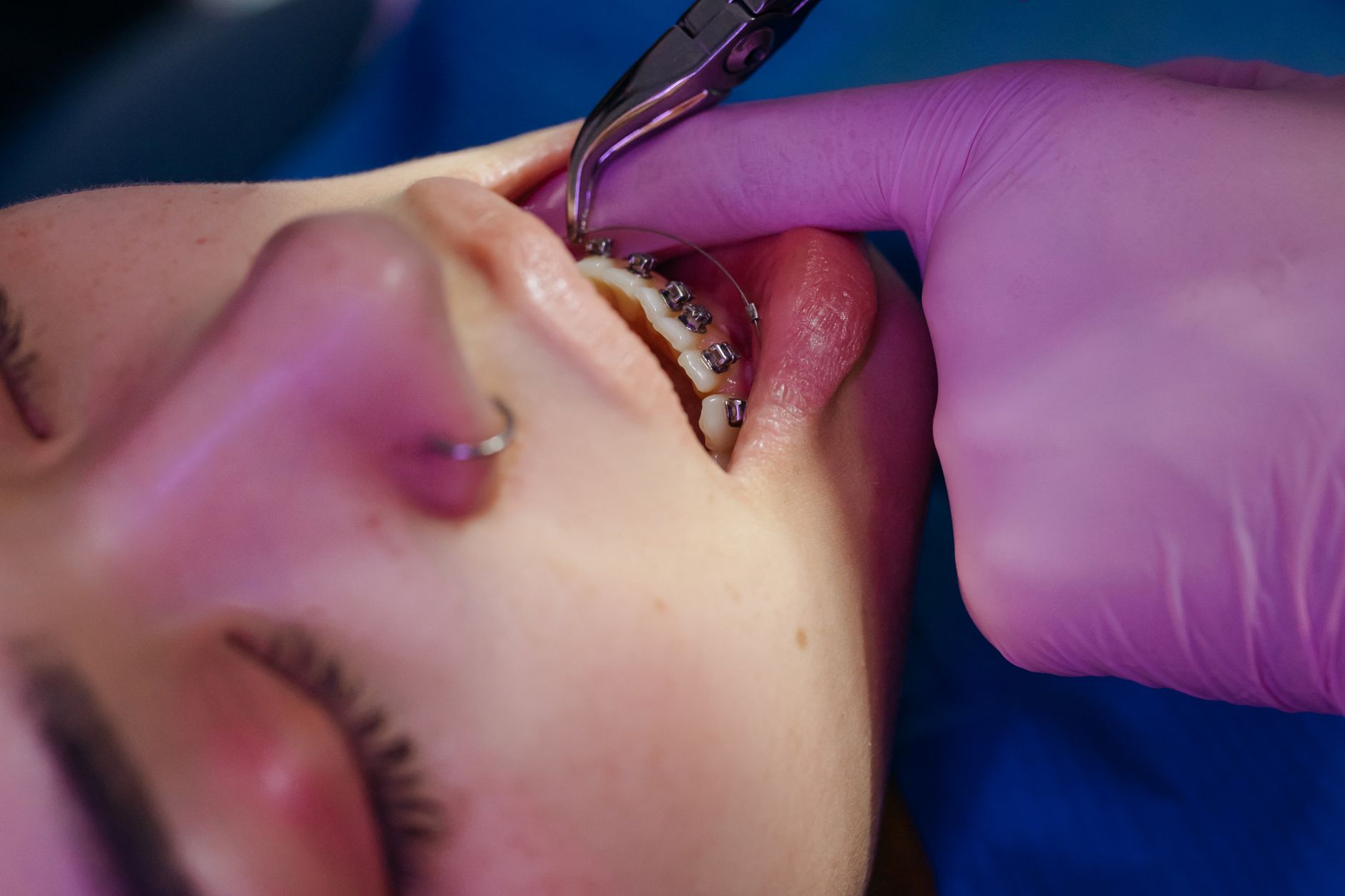 Tratamiento dental avanzado