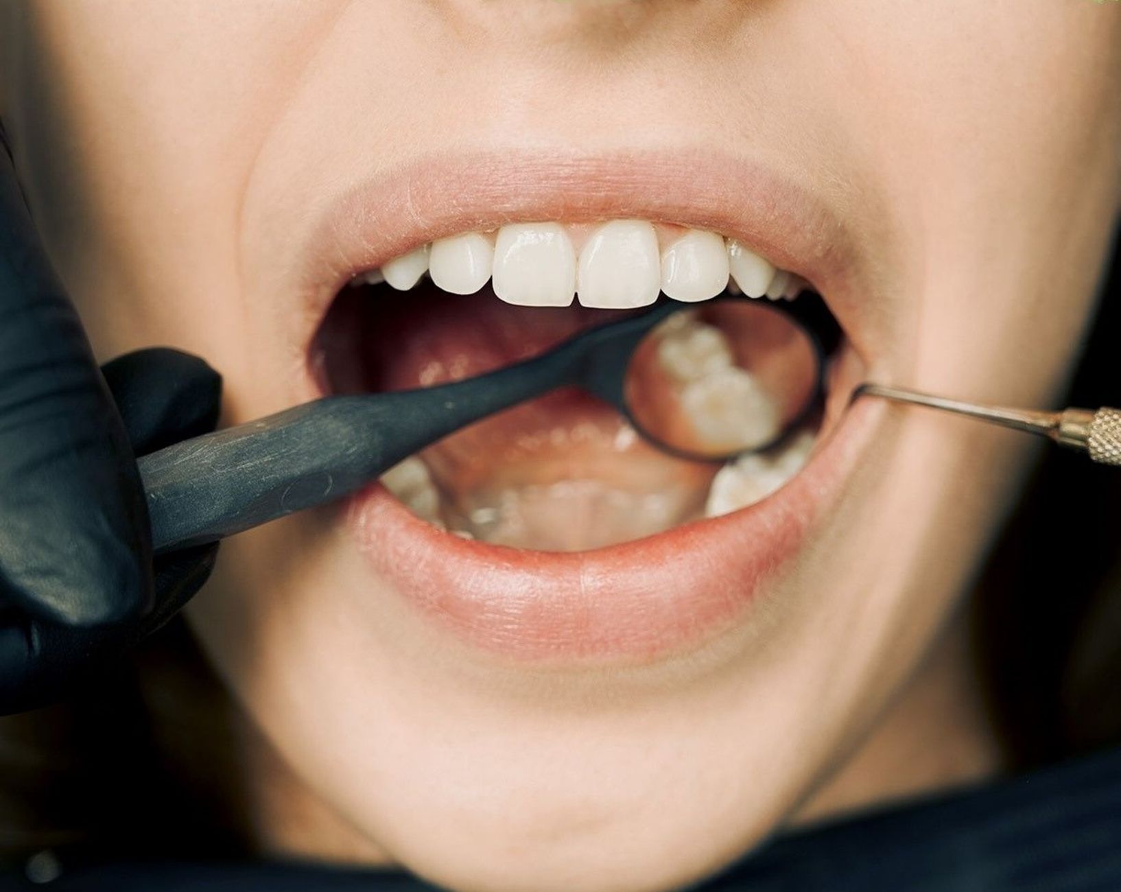 Almela Clínica Dental equipo profesional