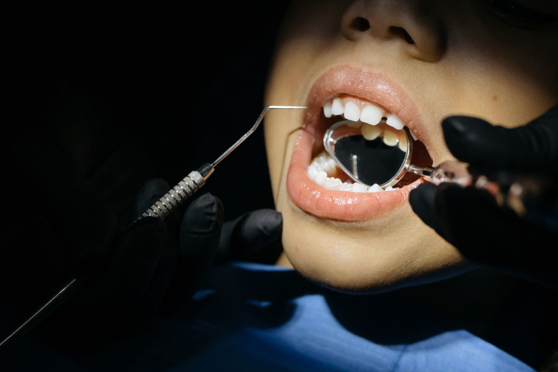 Dentista revisando la boca de un paciente en consulta dental