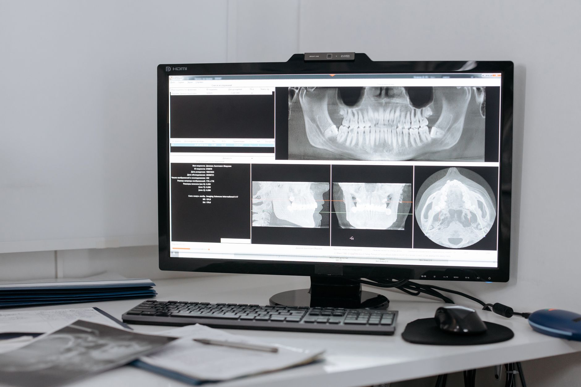 Servicios de clínica dental y radiología en Ensanche, Cuenca