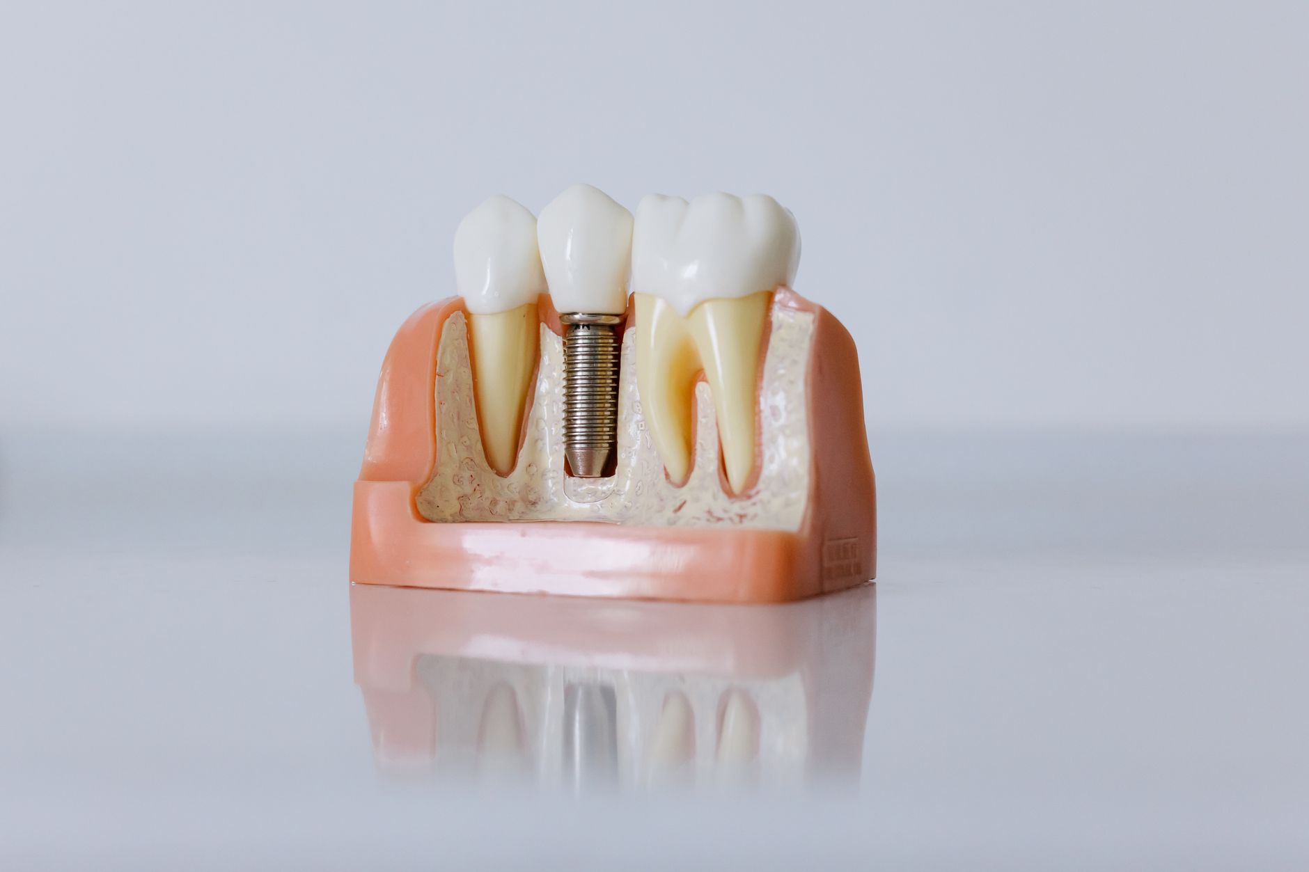 Equipo de implantología dental moderna