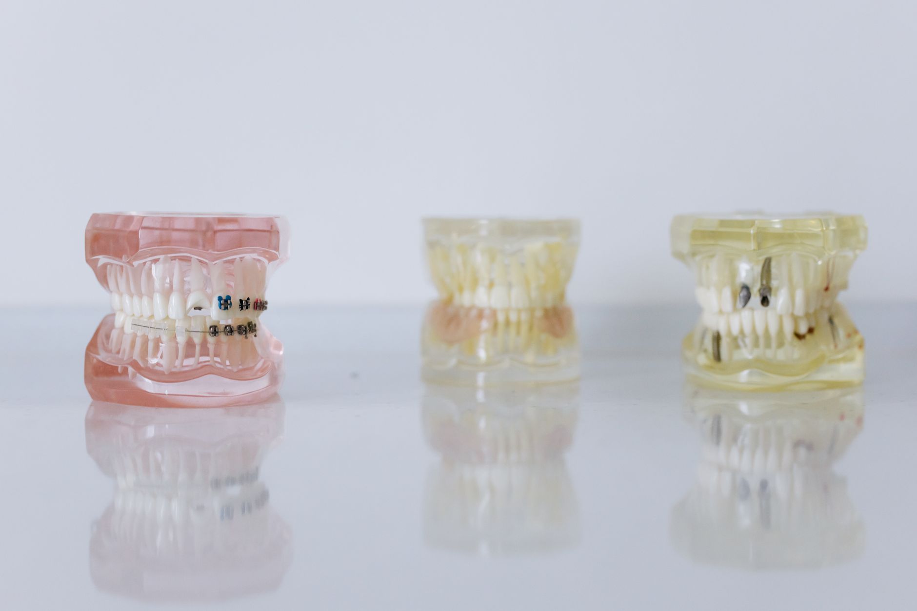 SmileDental Cádiz en Cádiz