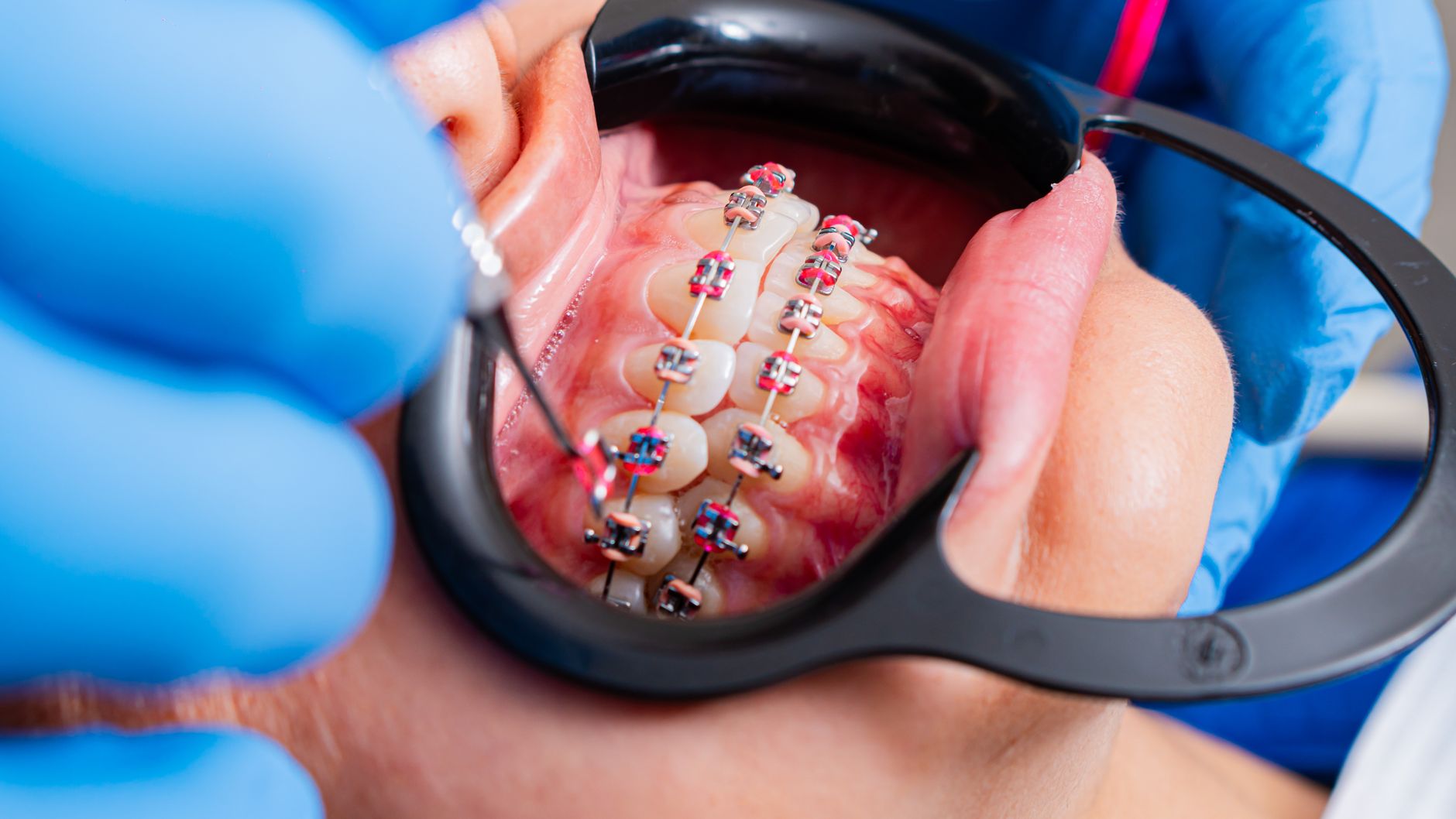Vitaldent Terrassa - Clínica Dental en Terrassa